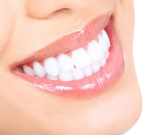 smile 2 160928 57ec398609997 300x279 1 Dentist Stratford | Dentist Near Me ON | Dental Office N5A 3J7 - Coventry Dental Care